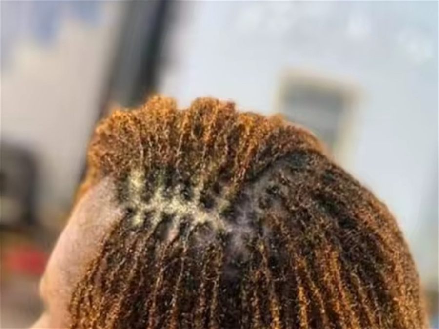 Close crop of neatly sectioned hair at the crown, the parting pattern used to start new locs
